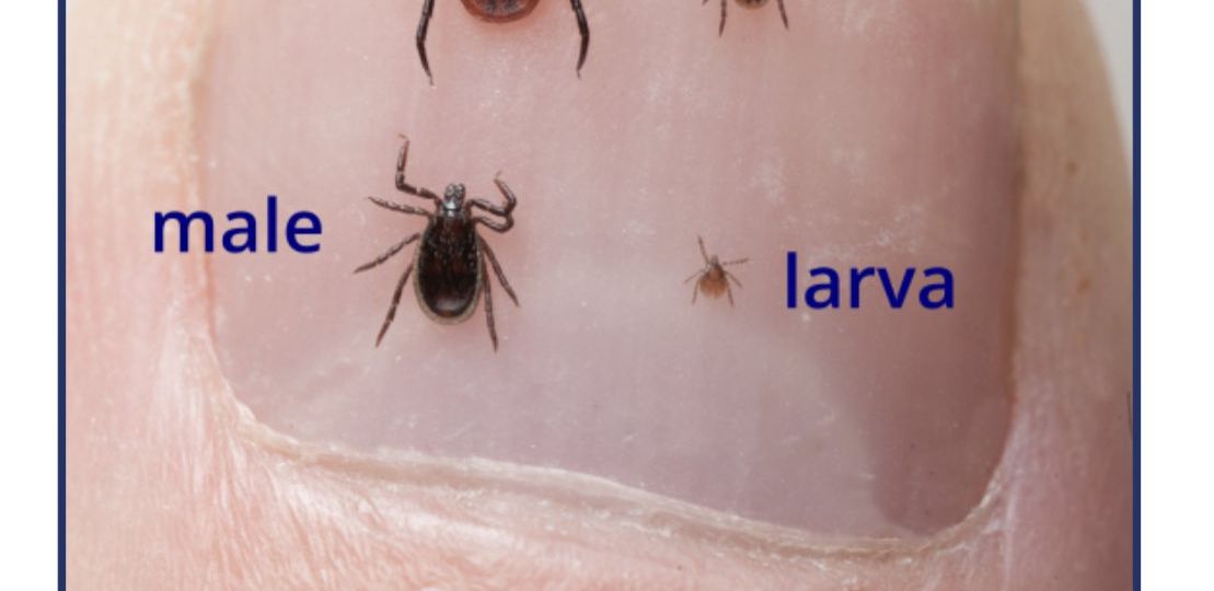 Image showing ticks